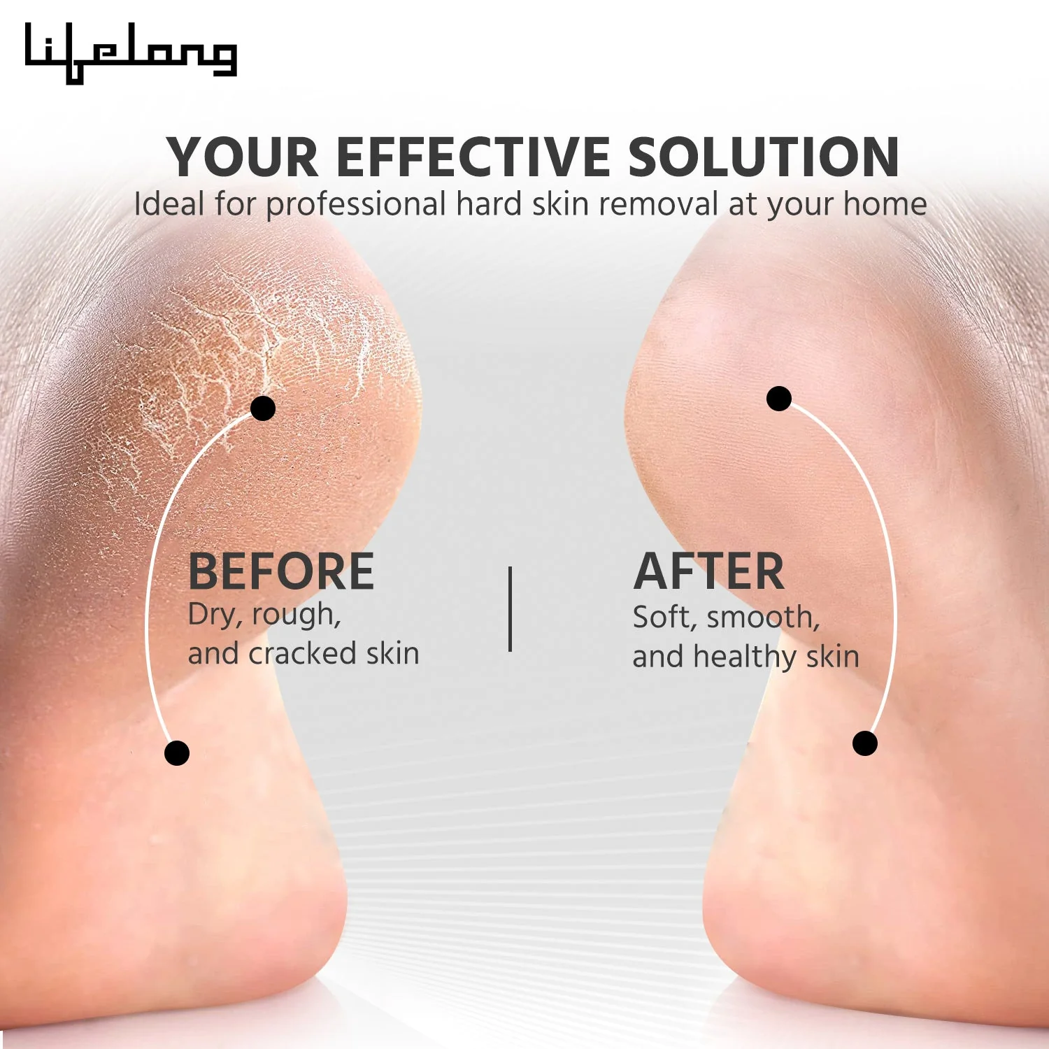 Electric Callus Remover5